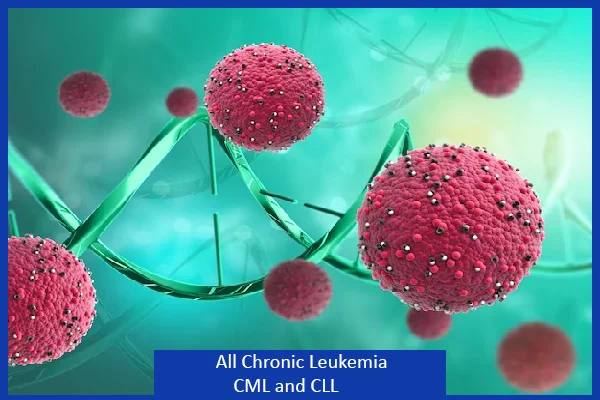 All Chronic Leukemia CML and CLL