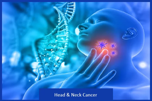 Head and Neck Cancer