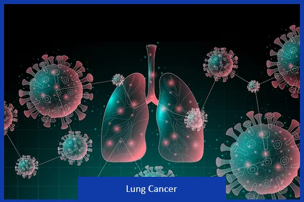 Lung Cancer